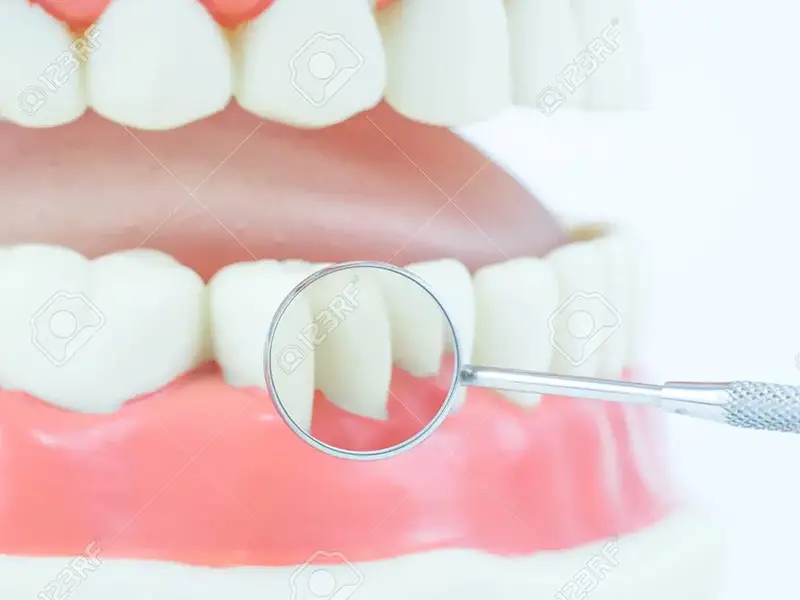 「齦」回健康，從「齒」開始!